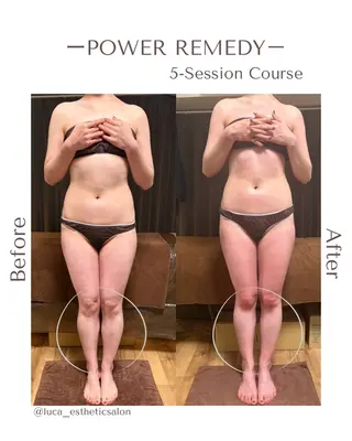Luca 痩身• 疲労改善×韓国肌管理のエステ・リラクイメージ