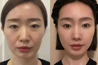 ネイル aliaハイフ&水光ジェットサロン所属・aliaハーブ水光店 エステティシャン募集のエステ・リラクイメージ