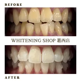 メンズ ホワイトニング ショップ葛西店のその他イメージ