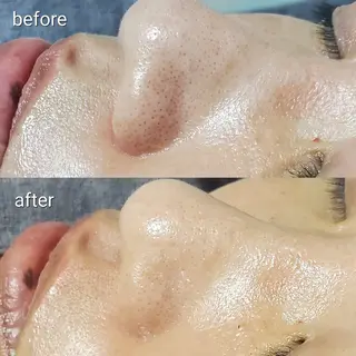 オーガニックエステ サロン　Graceのエステ・リラクイメージ