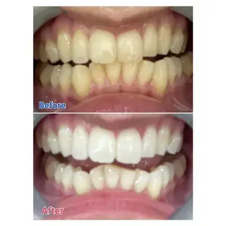 M渋谷 ホワイトニングのエステ・リラクイメージ