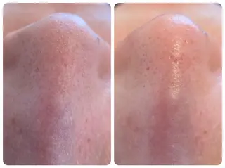 Hisui 種村のエステ・リラクイメージ