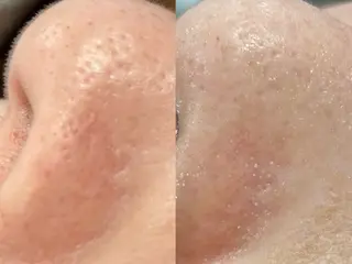 小顔＆肌質改善 NICORIのエステ・リラクイメージ