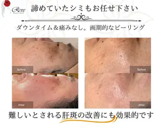 堀井 舞琳のエステ・リラクイメージ