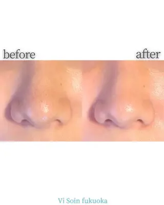 ソワン所属・脱毛 フェイシャル soin~ソワン~のエステ・リラクイメージ