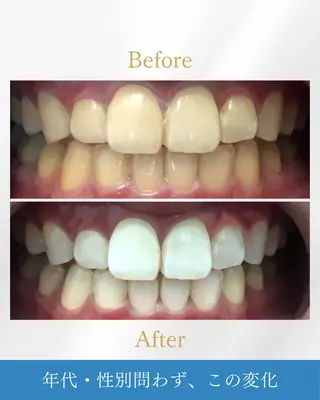 NAホワイトニング溝の口店所属・NAホワイトニング 溝の口店のエステ・リラクイメージ