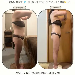 《本気痩せ×疲労改善 》  BILOOPのエステ・リラクイメージ