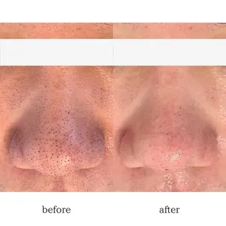 肌質改善🌿 彩也乃のエステ・リラクイメージ