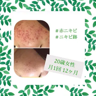 ミディアム カラー パーマ ヘアアレンジ メンズ キッズ ネイル マツエク・マツパ ニキビ・肌質改善専門 ♡人生が変わるサロンのエステ・リラクイメージ