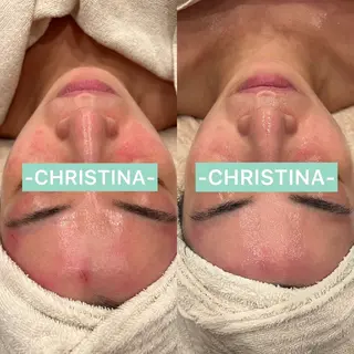 ベル チェリカ 三城のエステ・リラクイメージ