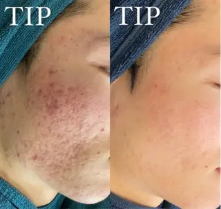 Ellebeauty relaxationのエステ・リラクイメージ