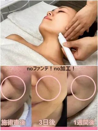 肌ケア＆毛穴洗浄 Cheri/女性専用のエステ・リラクイメージ