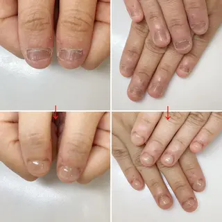 ネイル ネイルサロン アリュームのネイルデザイン