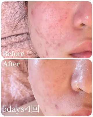 グリーンピール専門店 サロンY【大阪】のエステ・リラクイメージ