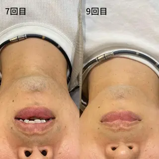 DUPE&MORE 店長kanaeのエステ・リラクイメージ