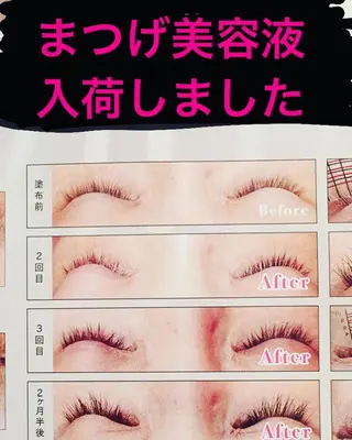 マツエク・マツパ 女性のお悩み美容 サロン ヴィーナスのエステ・リラクイメージ