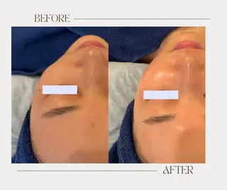 艶肌ワックス ALLY.のエステ・リラクイメージ