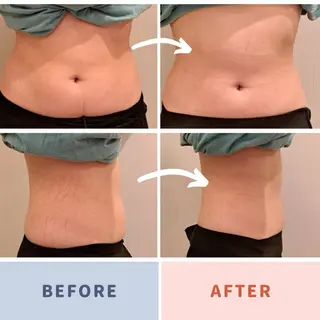 小顔・リフトアップ/ 奈緒美のエステ・リラクイメージ