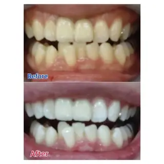 M渋谷 ホワイトニングのエステ・リラクイメージ