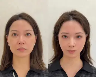 ネイル aliaハーブ水光店 エステティシャン募集のエステ・リラクイメージ