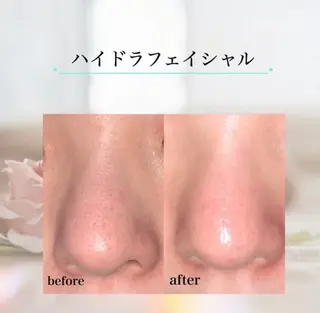 【都度払い専門店】 エステサロARTI,のエステ・リラクイメージ