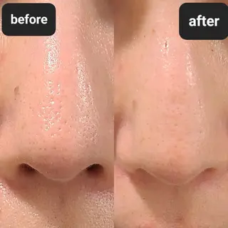 BEAUTYSARON　SiS.所属・高橋 沙奈江のエステ・リラクイメージ