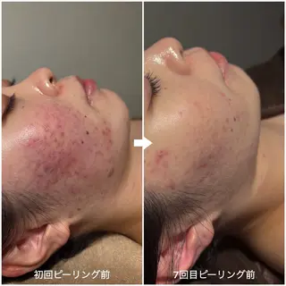 韓国肌管理×毛穴 改善専門🤍nanaのエステ・リラクイメージ