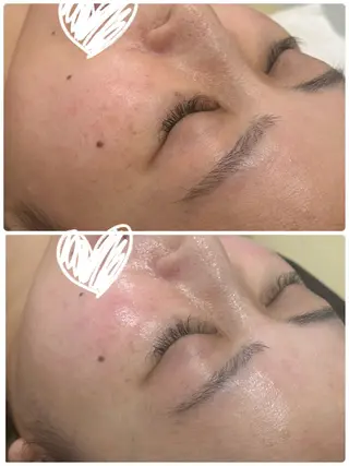 美容鍼灸サロンYOSHINO所属・美容鍼灸サロン YOSHINOのエステ・リラクイメージ