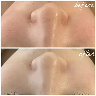 メンズ メナード岐阜市茜部 杉浦のエステ・リラクイメージ