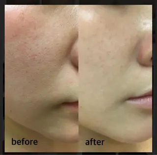 ロング ヘアアレンジ ネイル マツエク・マツパ アイブロウ 3/25迄ハーブ ピーリングBloomのエステ・リラクイメージ