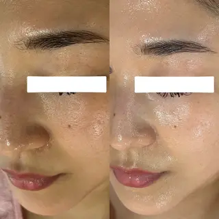 salondeBe 🩵フェイシャル専門のエステ・リラクイメージ