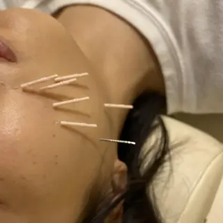 むくみたるみ専門☆ 美容鍼・小顔矯正のエステ・リラクイメージ