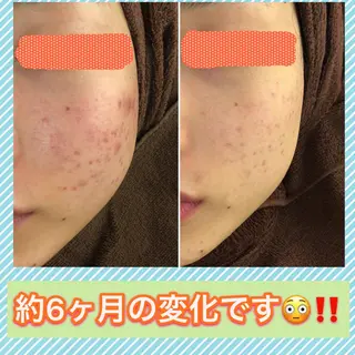 ミディアム カラー パーマ ヘアアレンジ メンズ キッズ ネイル マツエク・マツパ ニキビ・肌質改善専門 ♡人生が変わるサロンのエステ・リラクイメージ