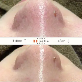 毛穴専門店Bébé 大阪中央店のエステ・リラクイメージ