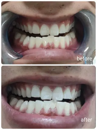 エクシアホワイト福岡六本松所属・喜多 美佳のその他イメージ