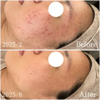 etes.tokyo 中目黒のエステ・リラクイメージ