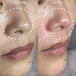 フェイシャルワックス KANAKOのエステ・リラクイメージ