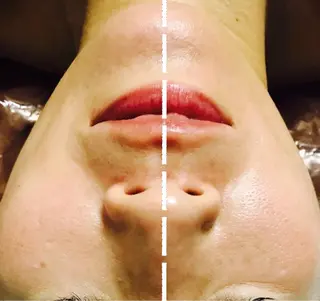 小顔専門店 桜Bisucuitのエステ・リラクイメージ