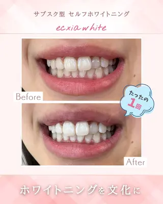 セルフホワイトニングエクシア天王寺店所属・セルフホワイトニング エクシア大阪天王寺店のその他イメージ
