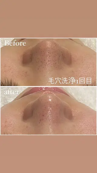 毛穴洗浄・痩身・脱毛 /アルカンジュのエステ・リラクイメージ