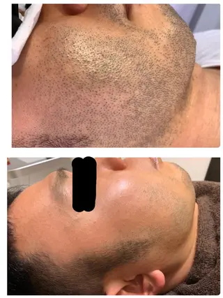 K-more名古屋店所属・松本 めめのエステ・リラクイメージ