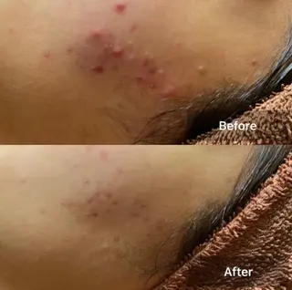 メンズ キッズ 美肌と癒しのサロン Lu,Mieのエステ・リラクイメージ