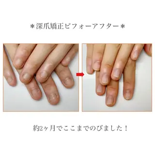 ネイル ネイルサロン アリュームのネイルデザイン