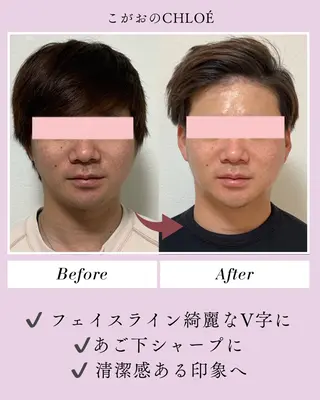 小顔サロン こがおのCHLOÉのエステ・リラクイメージ