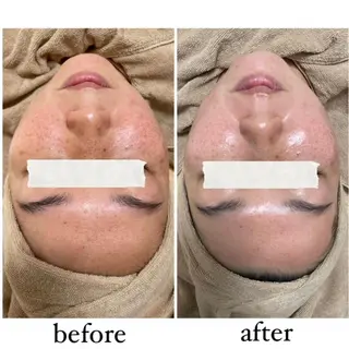 エステサロン Mi-mi.iのエステ・リラクイメージ