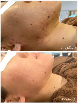 本気の肌質改善スキン デトックス🌿のエステ・リラクイメージ