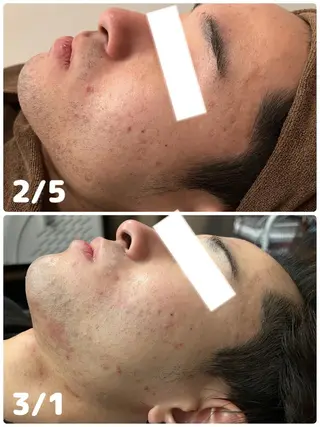 メンズ Folche博多 吉冨のエステ・リラクイメージ