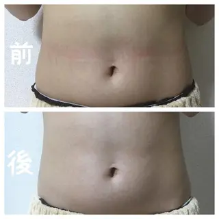 LUANA所属・ma ruのエステ・リラクイメージ