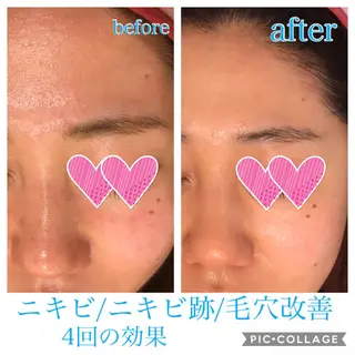 ロング カラー パーマ ヘアアレンジ キッズ ネイル マツエク・マツパ EnsorClair 代表 野口真央のエステ・リラクイメージ