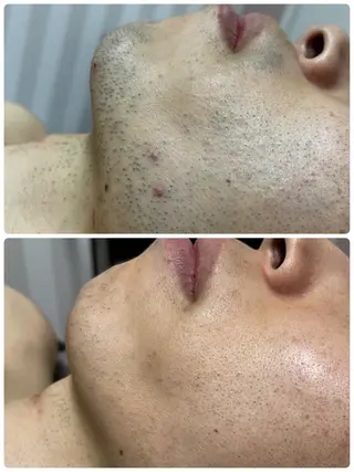 abeshial 〜美・健康・笑顔〜の眉毛・アイブロウイメージ